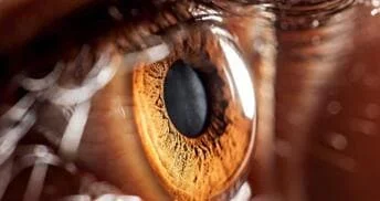 Ventajas de los lentes intraoculares de foco extendido